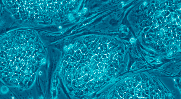 Human embryonic stem cells